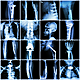 A new Spanish hospital to accommodate Irish patients waiting on orthopedic treatments
