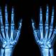 Calls for a review of personal injury awards in light of cost-of-living crisis