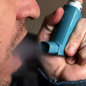 Calls made for more accessible and affordable asthma treatment Image
