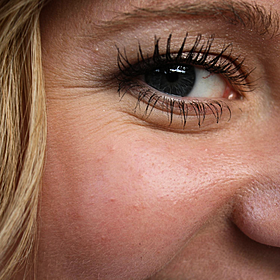 So You Think You’re an Adult: Should I get botox? Image