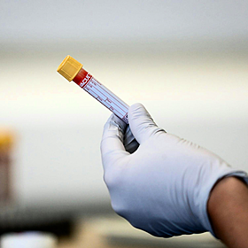 Cancer care delays causing serious concern Image