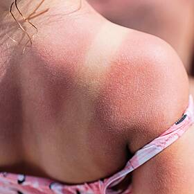"She Left Her Child With Severe Burns" - Horrific Parental Neglect Exposed By Neighbour Image