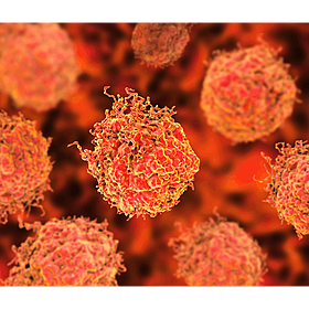 The symptoms and signs of prostate cancer Image