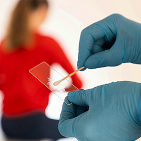 Leona Macken’s Cervical Cancer Story Image