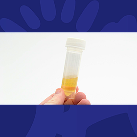 Irish Men Urged To Pay Attention To Your Pee Image