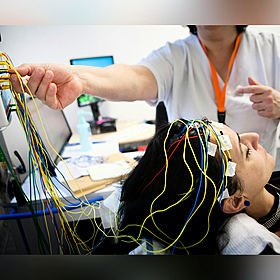 Do we fully understand epilepsy? Image