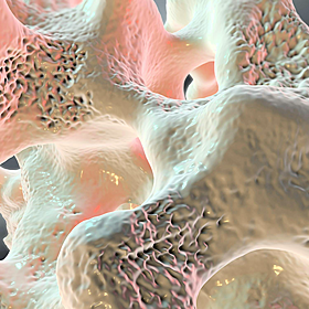 Osteoporosis campaign called ‘Unbreakable’ Image