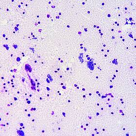 Futureproof Extra: Toxoplasma Gondii Image