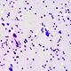 Futureproof Extra: Toxoplasma Gondii
