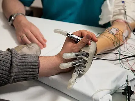 Bionic hand allows man to feel objects again after 10 years (video)