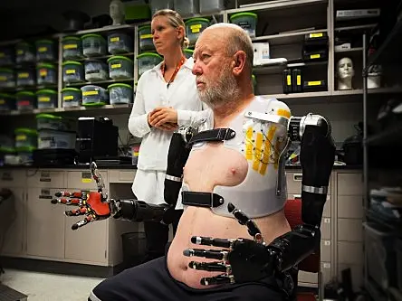 Double-amputee successfully tests highly-advanced bionic arms