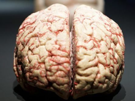 Irish team unlock hidden triggers behind Alzheimer’s and Parkinson’s