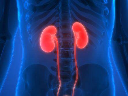 Human trials for new kidney disease treatment to begin