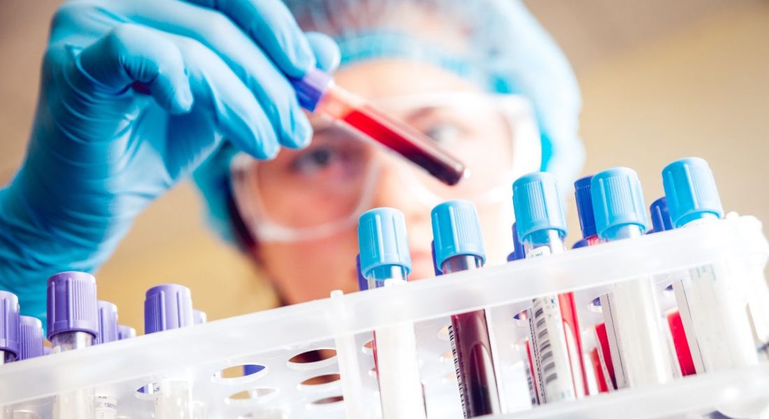 View of doctor in blue rubber gloves using dropper to add blood to test tube.