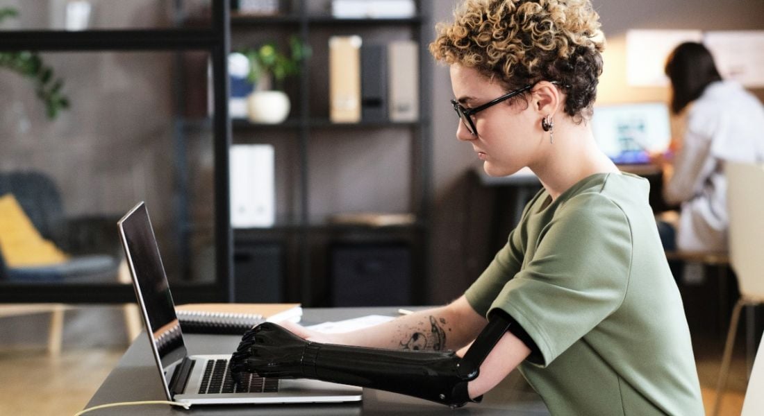 A young professional, with a prosthetic arm, who would benefit from the European Accessibility Act, works at her laptop.