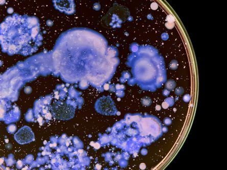 New antibiotic-resistant bacteria found in Limerick hospital