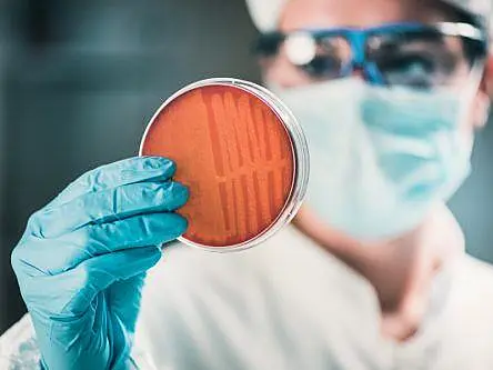 UCD research offers potential for new ways to fight MRSA superbug