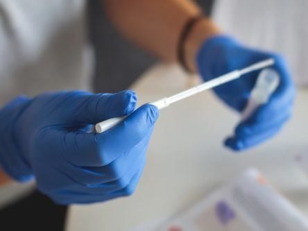 NUIG to share €200,000 funding to develop rapid coronavirus-testing device