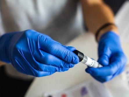 New LetsGetChecked Dublin lab to ramp up at-home coronavirus testing