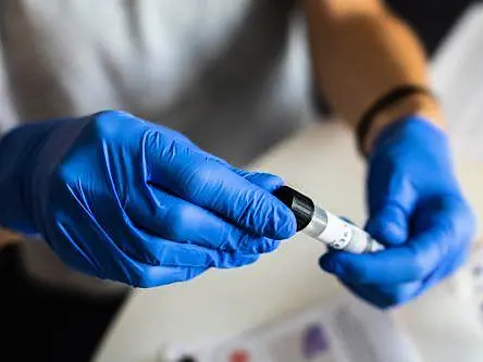 New LetsGetChecked Dublin lab to ramp up at-home coronavirus testing