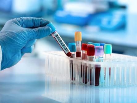 RCSI receives €1.3m to further develop prognostic blood test
