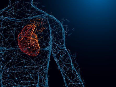 Irish-German OneProjects gets $17m pump for heart imaging tech