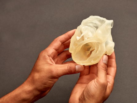 Belfast medtech Axial3D raises $15m to bring 3D printing to hospitals