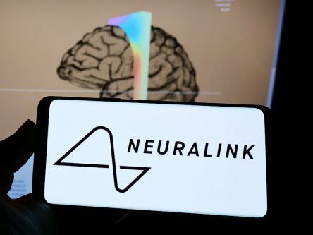 Musk’s Neuralink raises $280m and is expanding its team