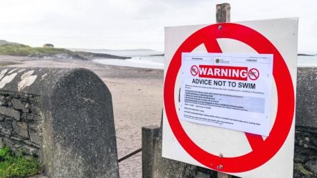 Local beaches closed due to bacteria Image