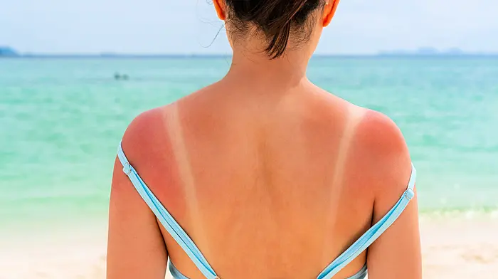Sunscreen still taxed as a ‘luxury product’ as dispensers called for Image