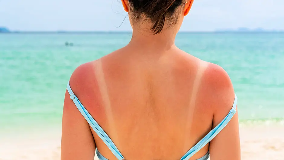 Sunscreen still taxed as a ‘luxury product’ as dispensers called for Image