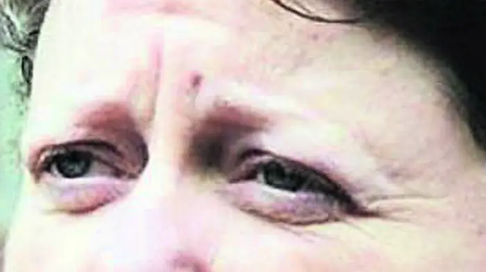 Airbnb may be used for victims of domestic abuse Image