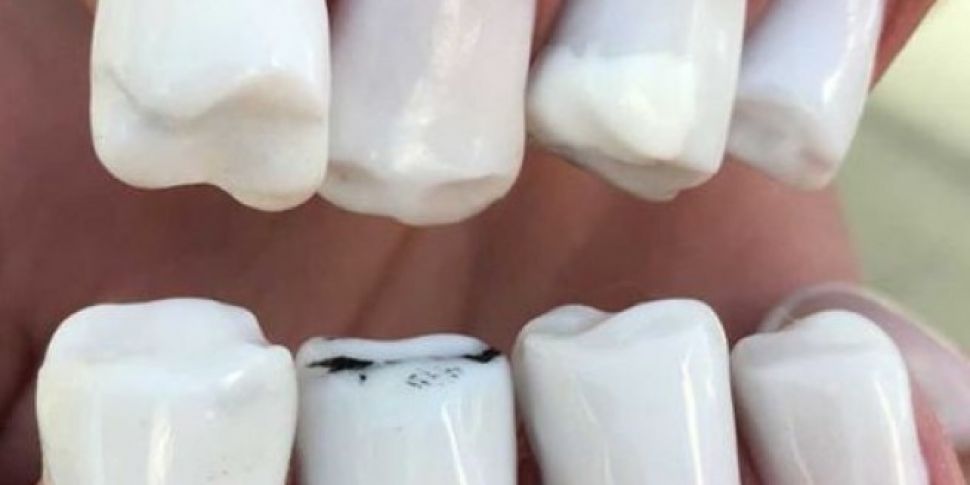Teeth Nails Are The Internet's...