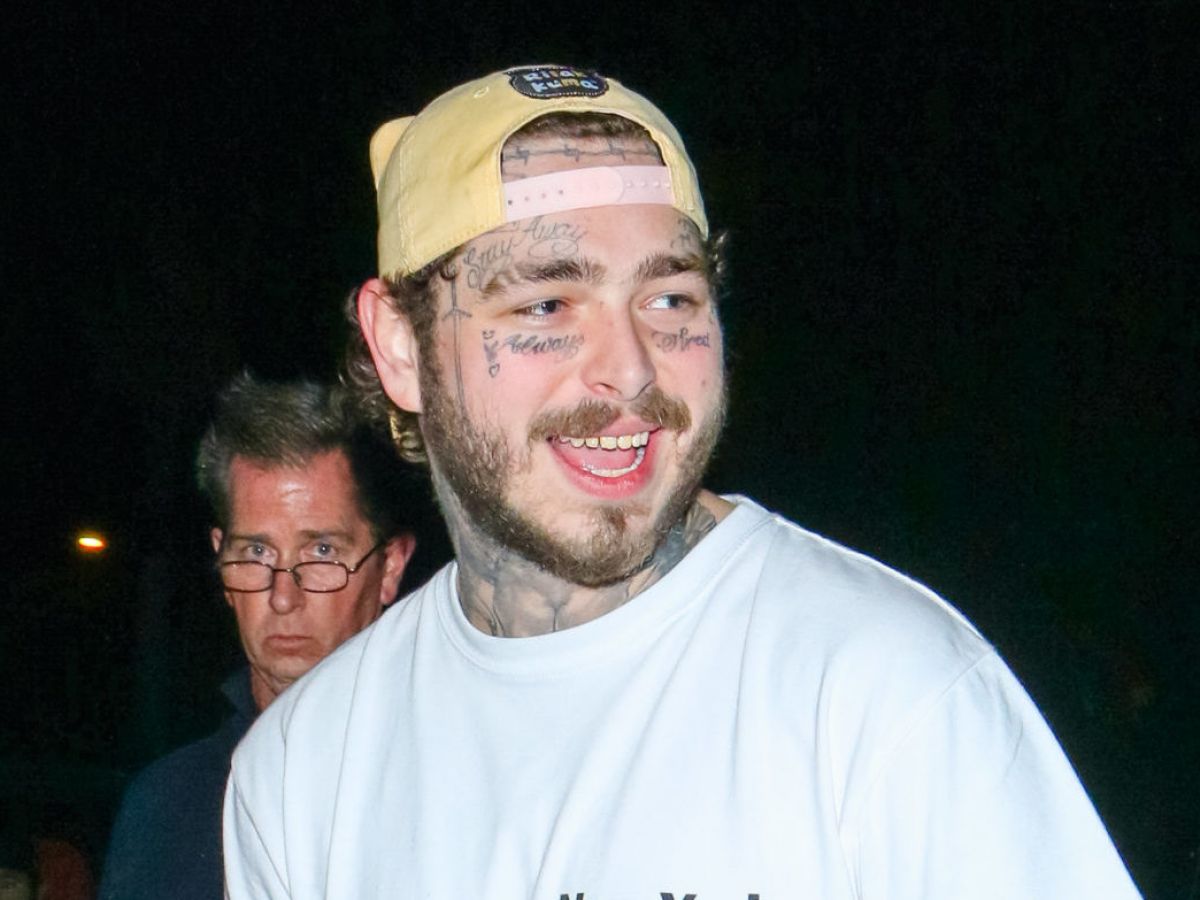 Post Malone Teeth Before And After : 3