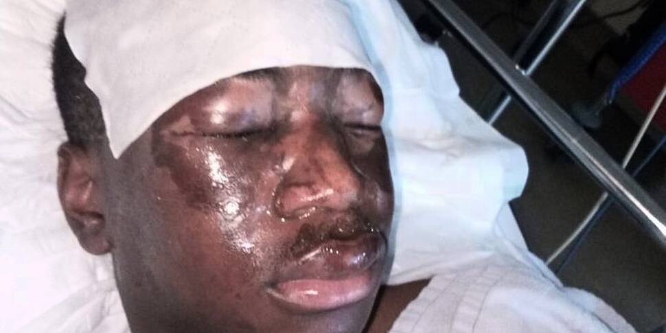 Mother Of Teen Injured In Wate...