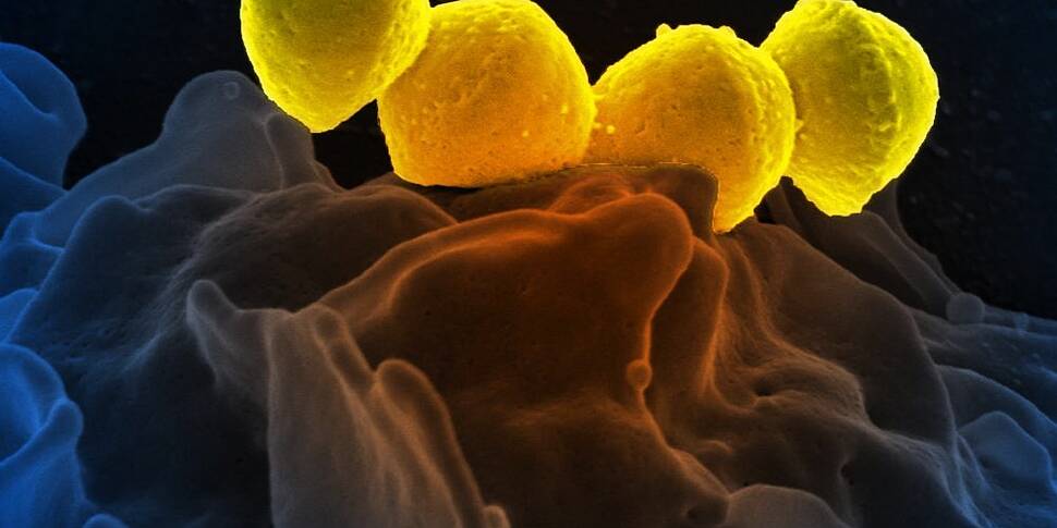 Watch Out For Signs Of Strep A...
