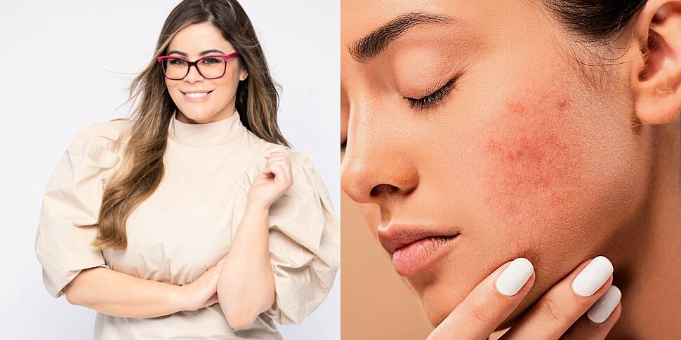 The Skin Nerd Tackles Your Bre...