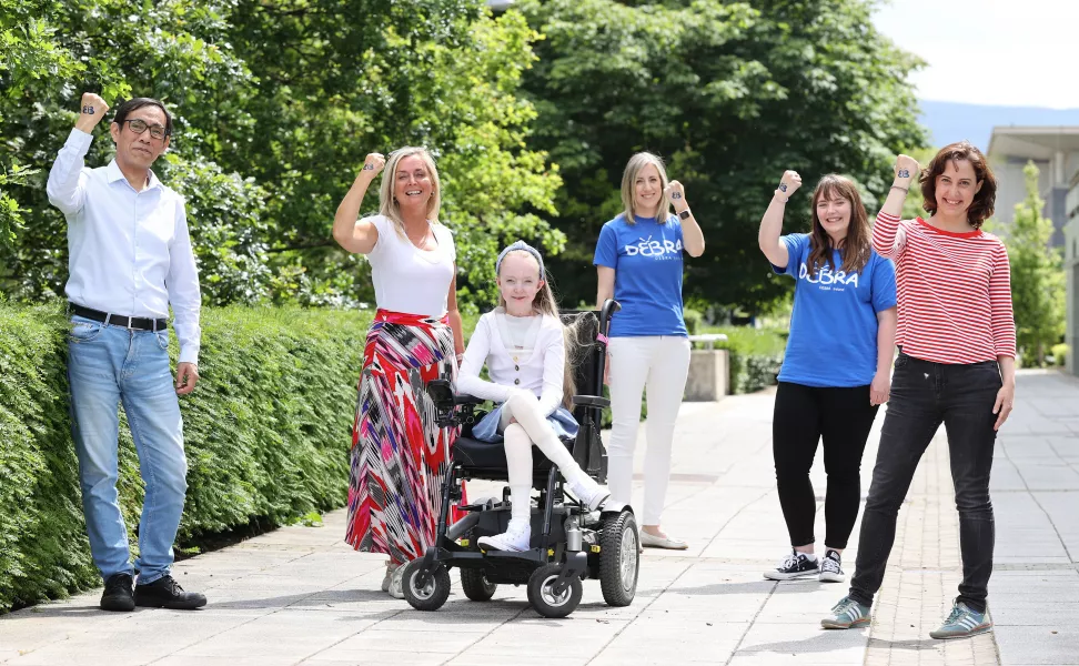 Professor Wenxin Wang, Liz Collins, Claudia Scanlon, Dr Sinead Hickey (DEBRA Ireland research manager), Sarah Mullins (DEBRA Ireland research officer), Dr Irene Lara-Saez pictured at the UCD Charles Institute of Dermatology