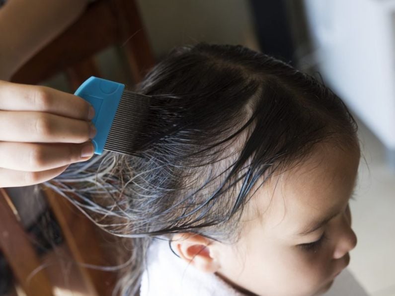 Listen back: Pharmacist Daragh Connolly talks head lice!