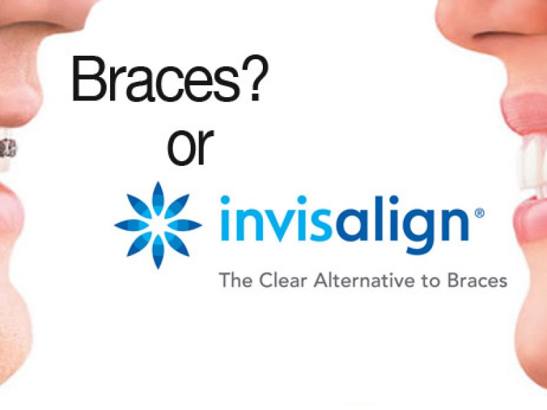 WIN: Clearbraces.ie are giving away cash all this week!