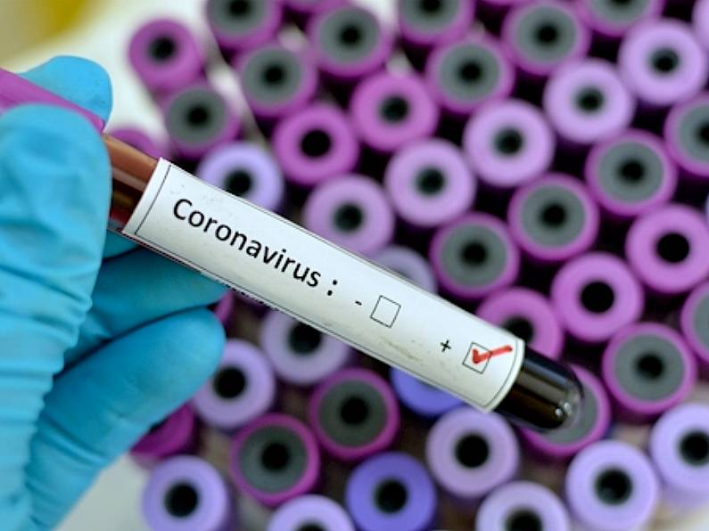 Authorities confirm no cases of coronavirus in Ireland